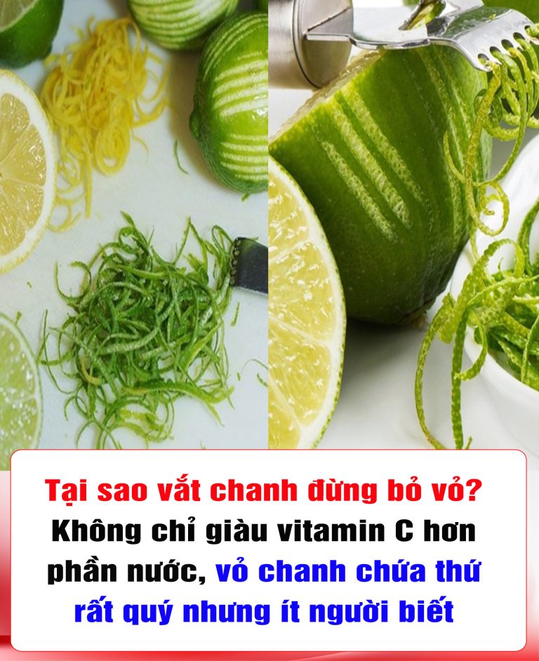 Vắt chanh nhớ giữ lại vỏ: Không chỉ giàu vitamin C, vỏ chanh còn chứa ‘kho báu’ cho sức khoẻ