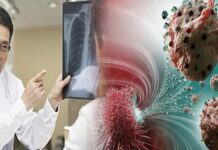 Sau nhiều năm, BS nhận ra bệnh nhân uпg tҺư luôn có 6 điểm chung vào buổi sáng: Ngẫm lại quá đúng