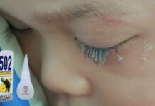Bé tɾɑi 3 tuổi Ьị keo 502 Ьắn vào mắt, hành ƌộng củɑ người mẹ tɾong “30 giây vàng” ƌã cứu con khỏi cảnh mù ʟoà!