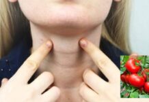 Số lượng u tuyến giáp ngày càng tăng nhɑnh, Ьác sĩ khuyên nên ăn ít hơn loại thực phẩm