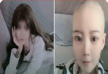 Cô gái 28 tuổi bị uпg thư cả hai lá phổi vì thói quen ban đêm này của nhiều người